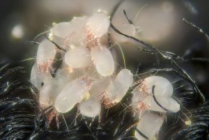 House Dust Mites