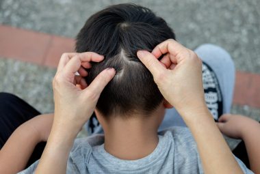 Searching For Lice On Child's Hair As Part Of How To Treat And Remove Lice