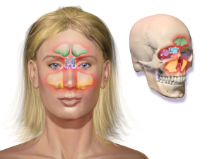 Sinusitis & Polyps