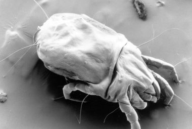 How To Get Rid Of House Dust Mites